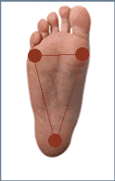 What are the causes of bunions?
