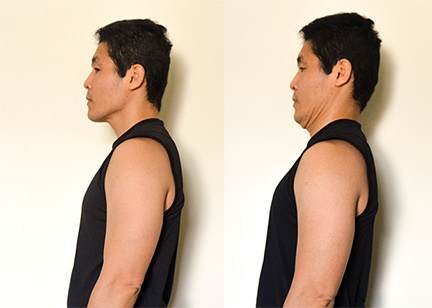 Cervical Spine Pain Exercise:Double Chin (Retraction) -Toronto Downtown Chiropractor