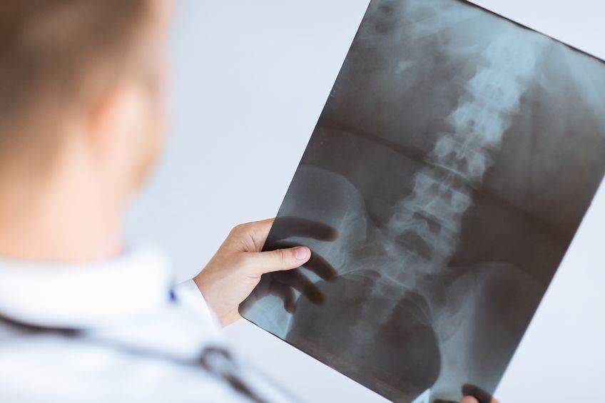 Why Is Disc Herniation Surgery Success Rate 50%?- Toronto Downtown Chiropractor
