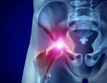 Snapping Hip Syndrome-Hip Pain: Toronto Downtown Chiropractor