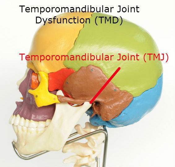 TMD Temporomandibular Joint Dysfunction: affects the temporomandibullar joint causing pain, soreness, clicking and even tinnitus Toronto Downtown Chirorpactor Dr. Ken Nakamura