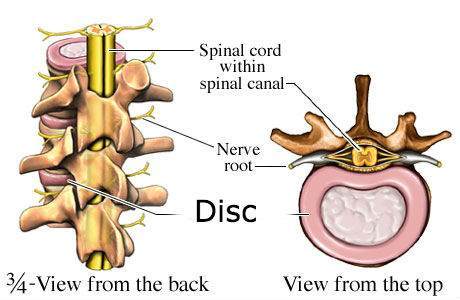 Nerve Root: Cervical Radiculopathy- Irritation of the nerve root can cause radiculopathy