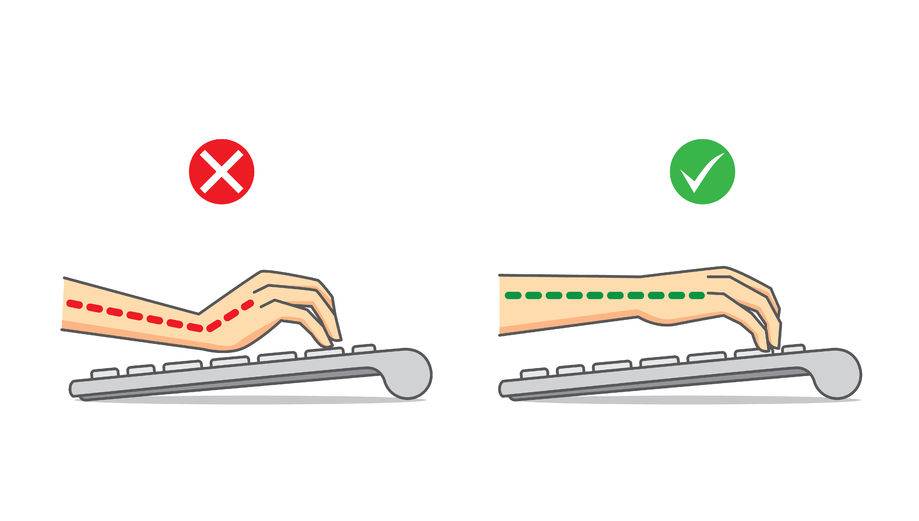 Proper Wrist Postion For Carpal Tunnel Syndrome| Dr Ken Nakamura Downtown Toronto Sports Chiropractor | Best Toronto Chiropractic