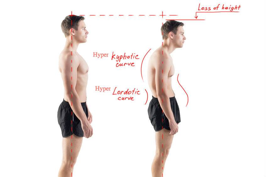 Getting Taller By Improving Your Posture | Dr Ken Nakamura Best Toronto Chiropractor