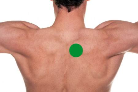 Upper Back Pain:The Green Circle Shows The Typical Area Of Upper Back Pain Near The Shoulder Blade Causing Shoulder Blade Pain- Toronto Downtown Chiropractor