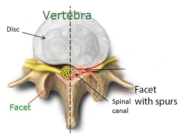 Facet Joint|Facet Joint Pain Downtown Toronto Chiropractor