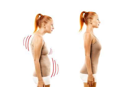 How to Improve Posture-Ideal and Bad Posture: Toronto Chiropractic Clinic