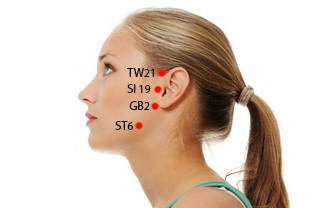 TMJ Treatment Remedies - Toronto Downtown Chiropractor