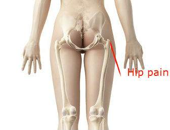 Hip Impingement Syndrome: Why Do I Have Hip Pain: Downtown Toronto Chiropractor