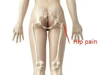 Hip Impingement Syndrome: Why Do I Have Hip Pain: Downtown Toronto Chiropractor