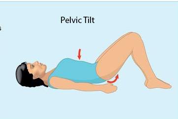 Pelvic Tilt: Spinal Stenosis Comprehensive Guide: 5 Exercises For Your Spinal Stenosis & Lateral Stenosis: Toronto Downtown Chiropractor