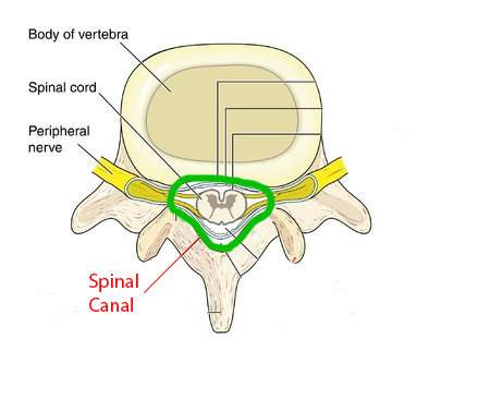 Spinal Canal - Spinal Stenosis Comprehensive Guide: 5 Exercises For Your Spinal Stenosis & Lateral Stenosis: Toronto Downtown Chiropractor