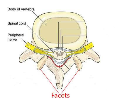 Vertebra Showing The Facets. Pressure is Shifted to the Back of The Annulus and Facets: Degenerative Disc Disease: Downtown Toronto Chiropractic