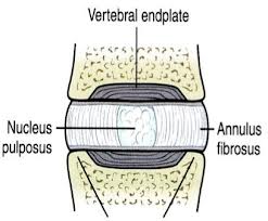 Disc Showing Annulus, Nucleus, and Endplates: Downtown Toronto Chiropractic